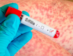 Kasus Sifilis Meningkat, Kemenkes Gencarkan Skrining Dini